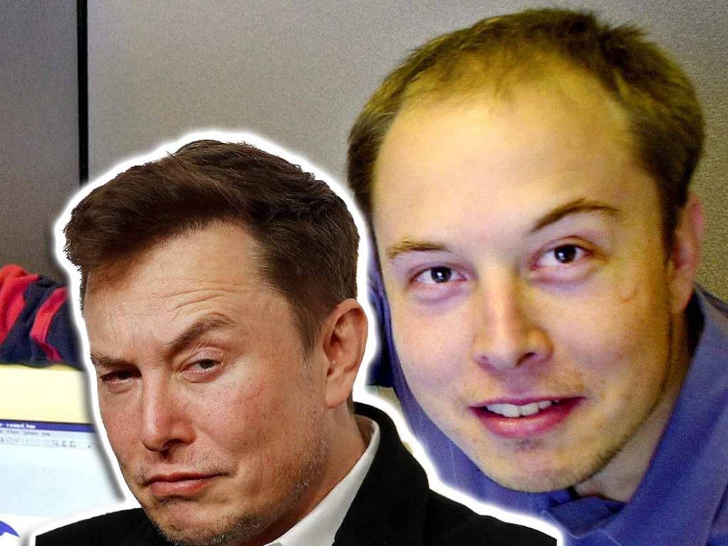 elon-musk-hair-surgery-1024x768.jpg